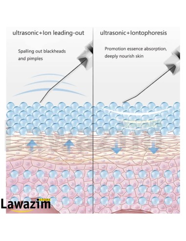 مقشر الجلد بالأمواج فوق الصوتية لتنظيف الوجه Épurateur de peau à ultrasons pour nettoyage du visage