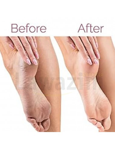 أداة باديكير للعناية بالقدمين  Finishing Touch Flawless Pedi