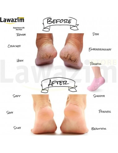 جوارب من الهلام  الناعم طبية للعناية ببشرة القدم / SPA Chaussettes en gel de SPA
